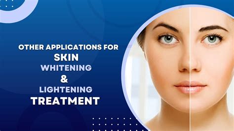 Best Skin Whitening Treatment .
